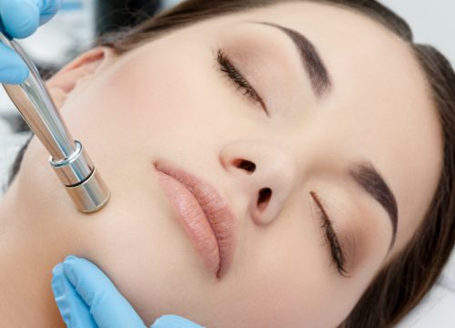 Woman receiving microdermabrasion treatments
